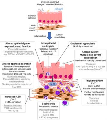 Mechanisms Mediating Pediatric Severe Asthma and Potential Novel Therapies